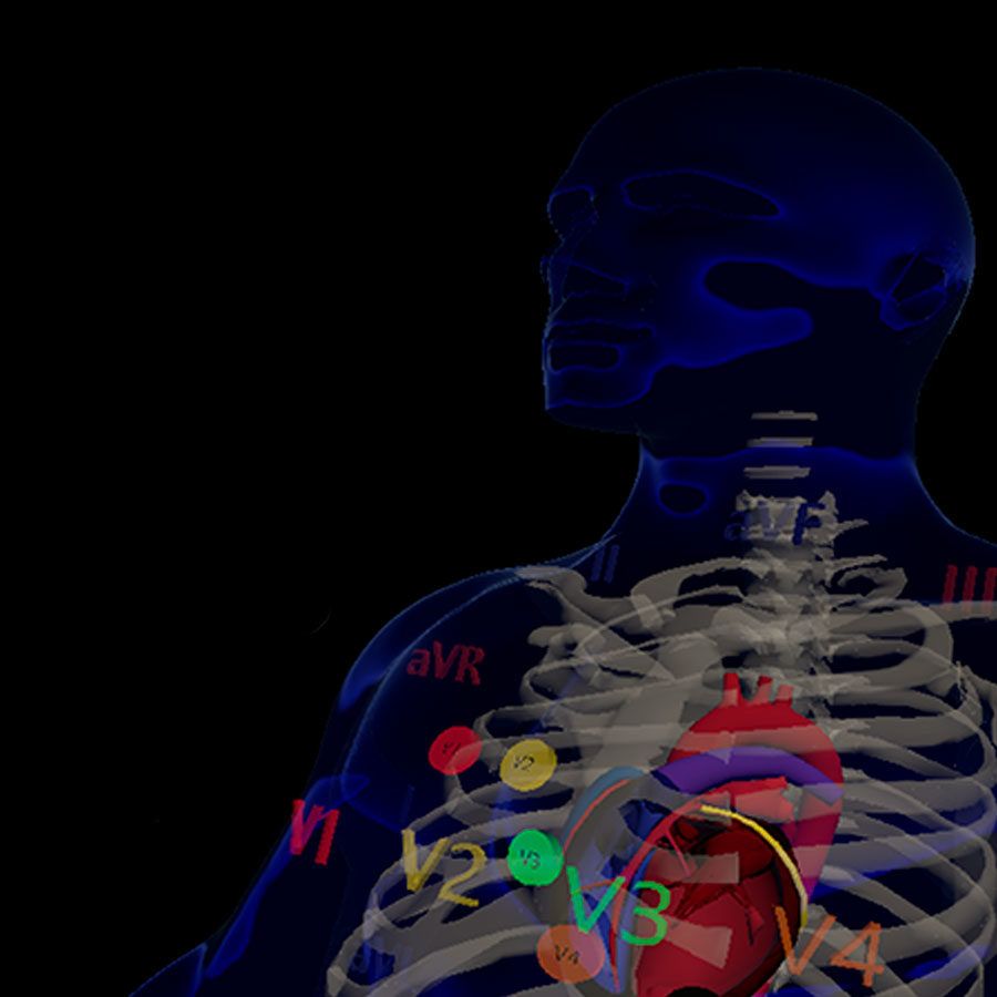 Screenshot aus der Arbeit "Easy ECG" von Susanna Götz